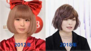 きゃりーぱみゅぱみゅの顔が変化した5つの理由！時系列で画像比較してみた！ | NEXT JOURNAL